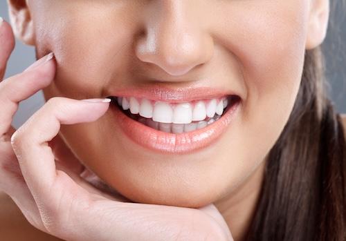 A smiling woman after getting cosmetic dental treatments in Indianapolis