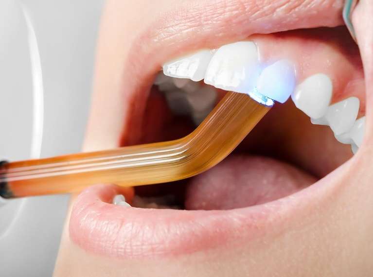 A patient having a curing light used on her teeth