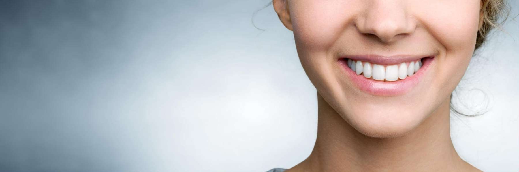 Porcelain Veneers | Dentist