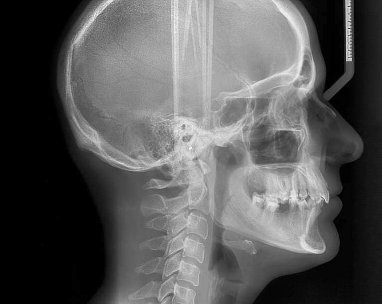 A cephalometric x-ray